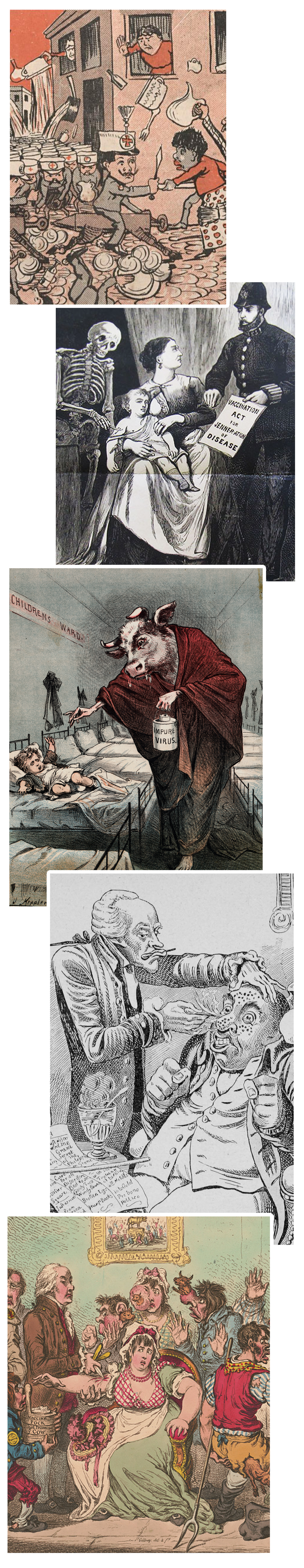 Mistrust of vaccinations has a long history, as depicted in these cartoons and posters created in response to the smallpox vaccine