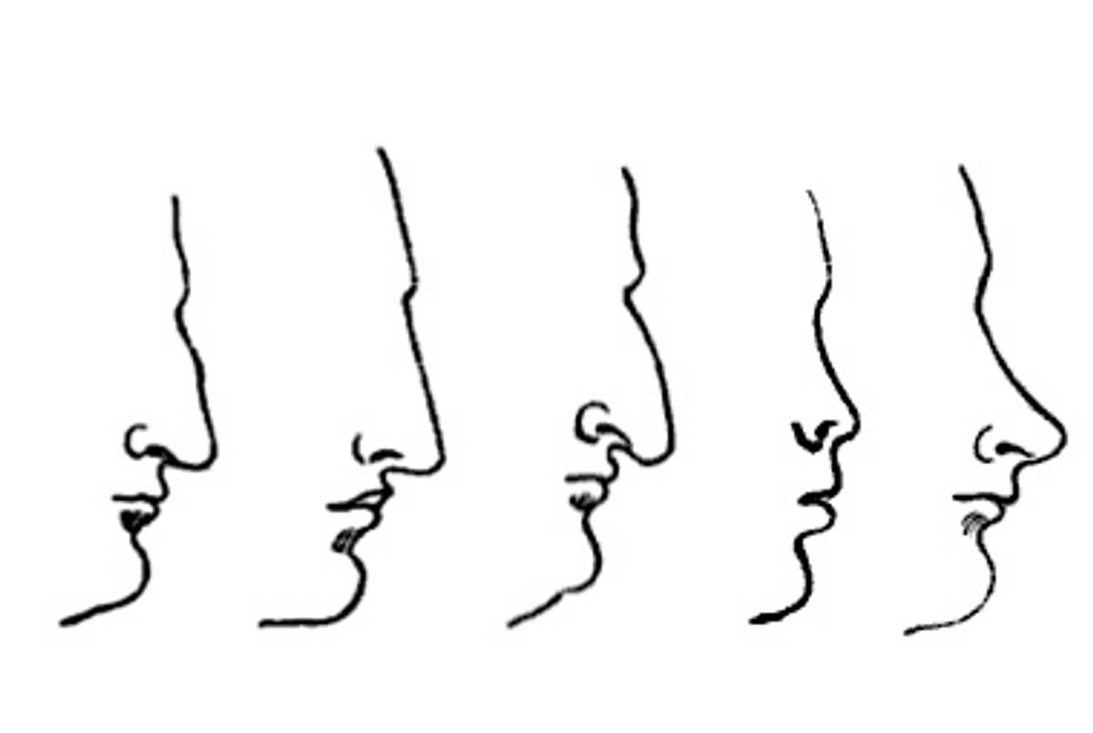 From left to right: the Roman, the Greek, the Jewish, the Snub, and the Celestial noses.(From Nasology: or hints towards a classification of noses by Eden Warwick (Rich. Bentley, 1848))