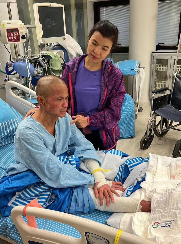 Wanchai Monsana (with Chotika Fuchs) recovers at the burn unit at Sheba Medical Center, Ramat Gan