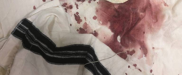 The bloody tzitzit of Abraham Gopin after he was attacked on Aug. 27 in Brooklyn.