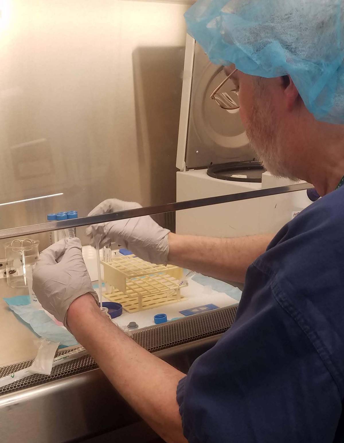 An embryologist performs ICSI, injecting one sperm into an egg