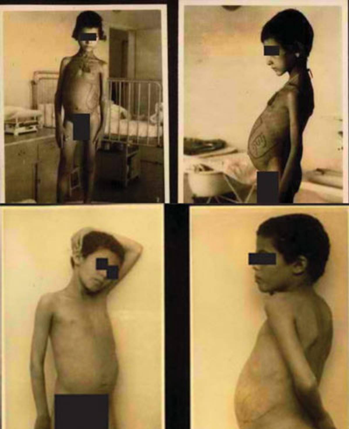 Photographs taken between 1948-1955 of hospitalized Yemeni children at Rambam Hospital, Haifa (Israeli State Archives)