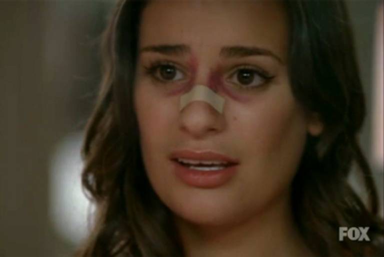 Glee's Rachel Berry contemplates getting a nose job.(Fox)